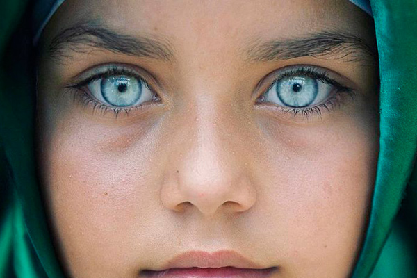 Children with exceptionally colourful eyes